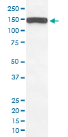 Western Blot (Cell lysate)