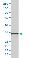 Western Blot (Cell lysate)