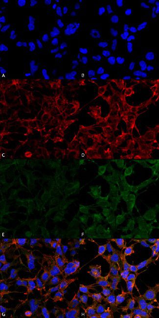 Immunocytochemistry