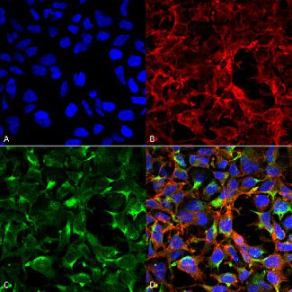 Immunocytochemistry