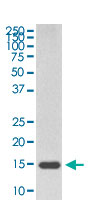 Western Blot (Cell lysate)