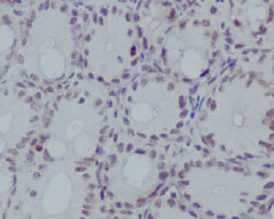 Immunohistochemistry (Formalin/PFA-fixed paraffin-embedded sections)