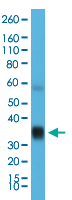 Western Blot (Tissue lysate)