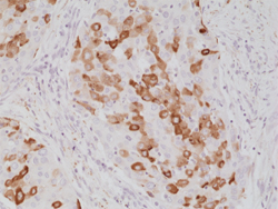 Immunohistochemistry (Formalin/PFA-fixed paraffin-embedded sections)