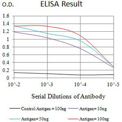 Enzyme-linked Immunoabsorbent Assay