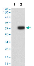 Western Blot (Transfected lysate)