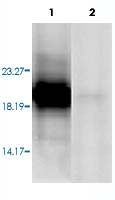 Western Blot (Tissue lysate)