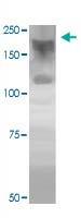 Western Blot (Cell lysate)