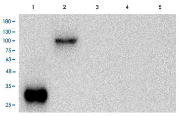 Western Blot (Recombinant protein)