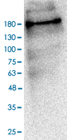 Western Blot (Transfected lysate)