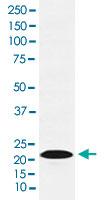 Western Blot (Cell lysate)