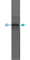 Western Blot (Tissue lysate)