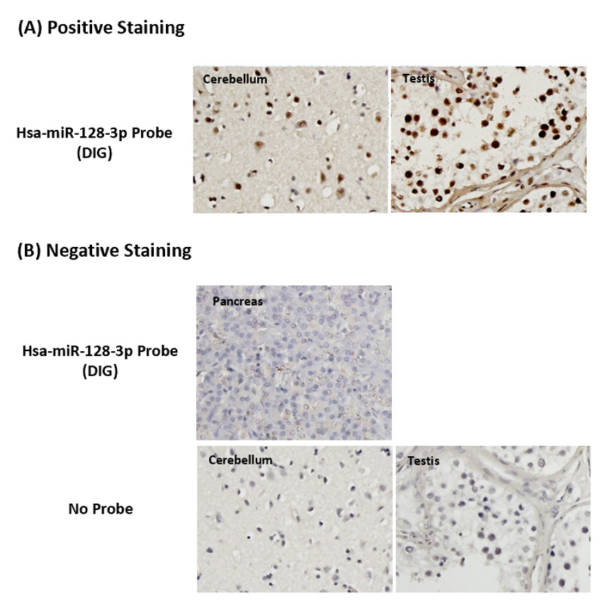 Chromogenic <i>In Situ</i> Hybridization (FFPE Tissue)