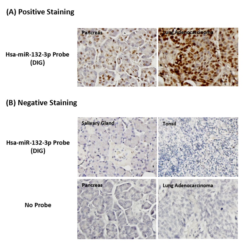 Chromogenic <i>In Situ</i> Hybridization (FFPE Tissue)