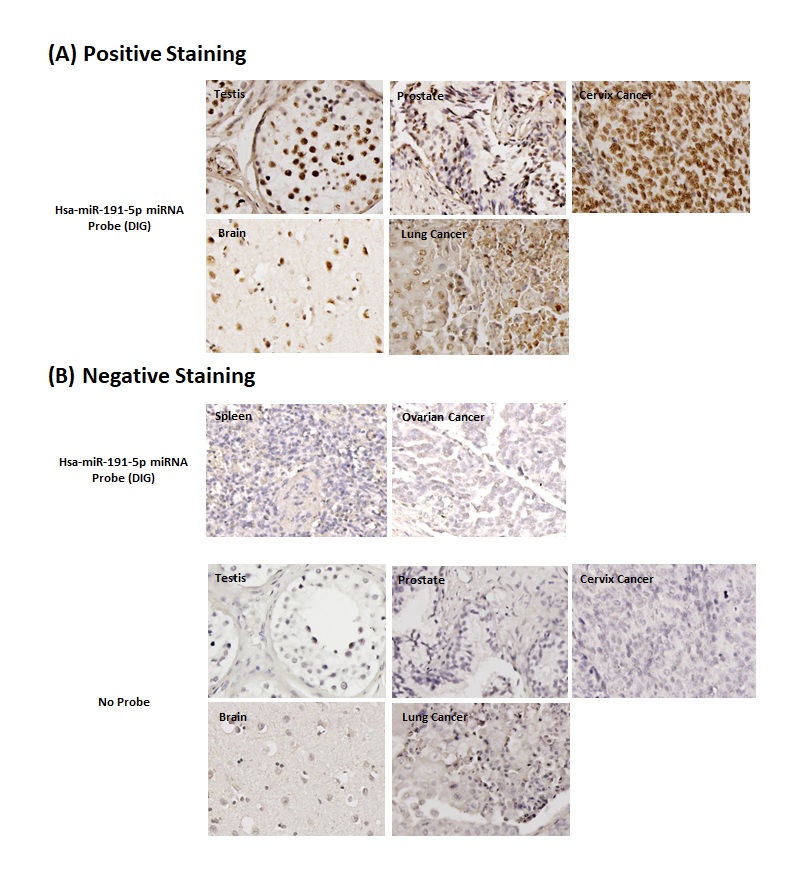 Chromogenic <i>In Situ</i> Hybridization (FFPE Tissue)