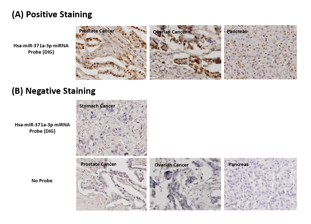 Chromogenic <i>In Situ</i> Hybridization (FFPE Tissue)