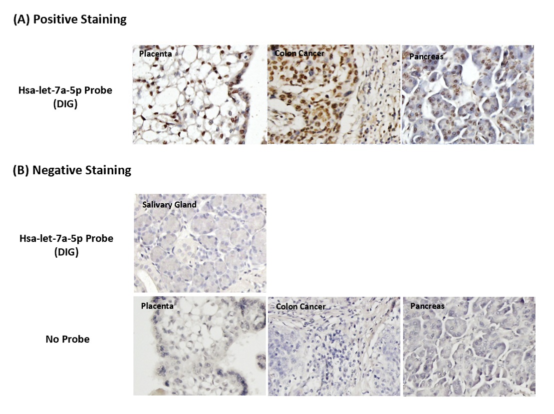 Chromogenic <i>In Situ</i> Hybridization (FFPE Tissue)