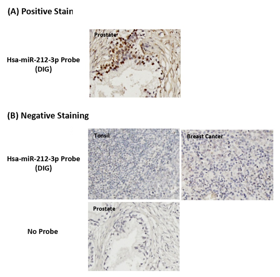 Chromogenic <i>In Situ</i> Hybridization (FFPE Tissue)