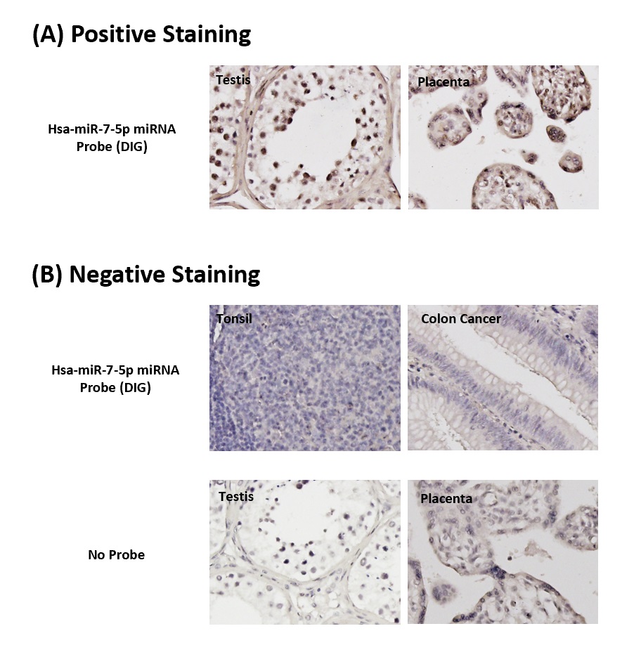 Chromogenic <i>In Situ</i> Hybridization (FFPE Tissue)