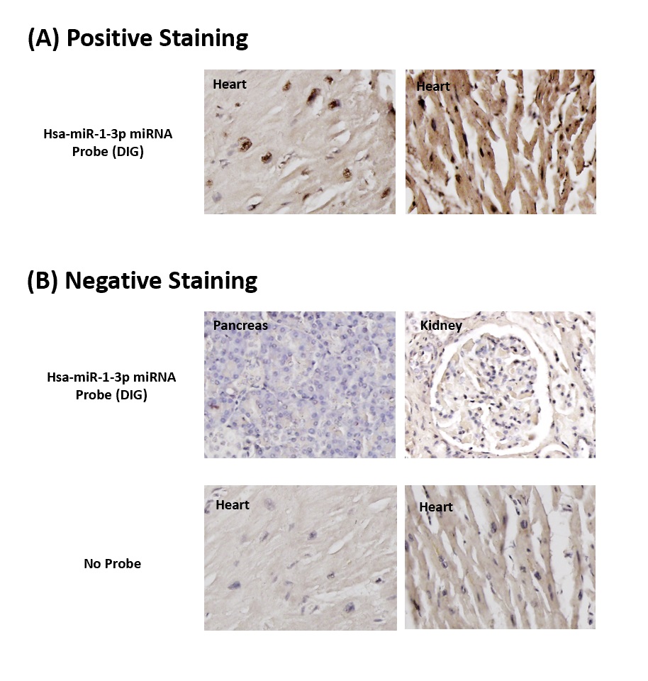 Chromogenic <i>In Situ</i> Hybridization (FFPE Tissue)