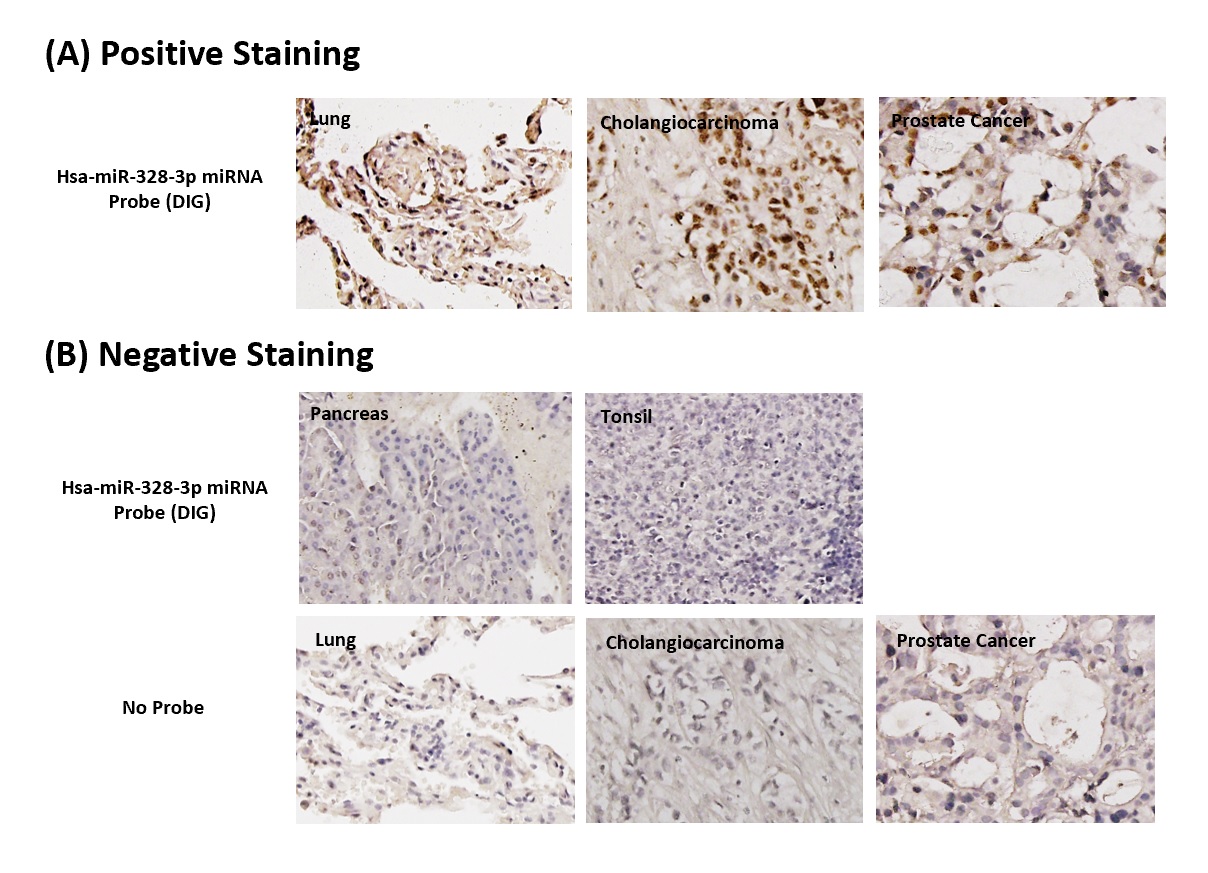 Chromogenic <i>In Situ</i> Hybridization (FFPE Tissue)