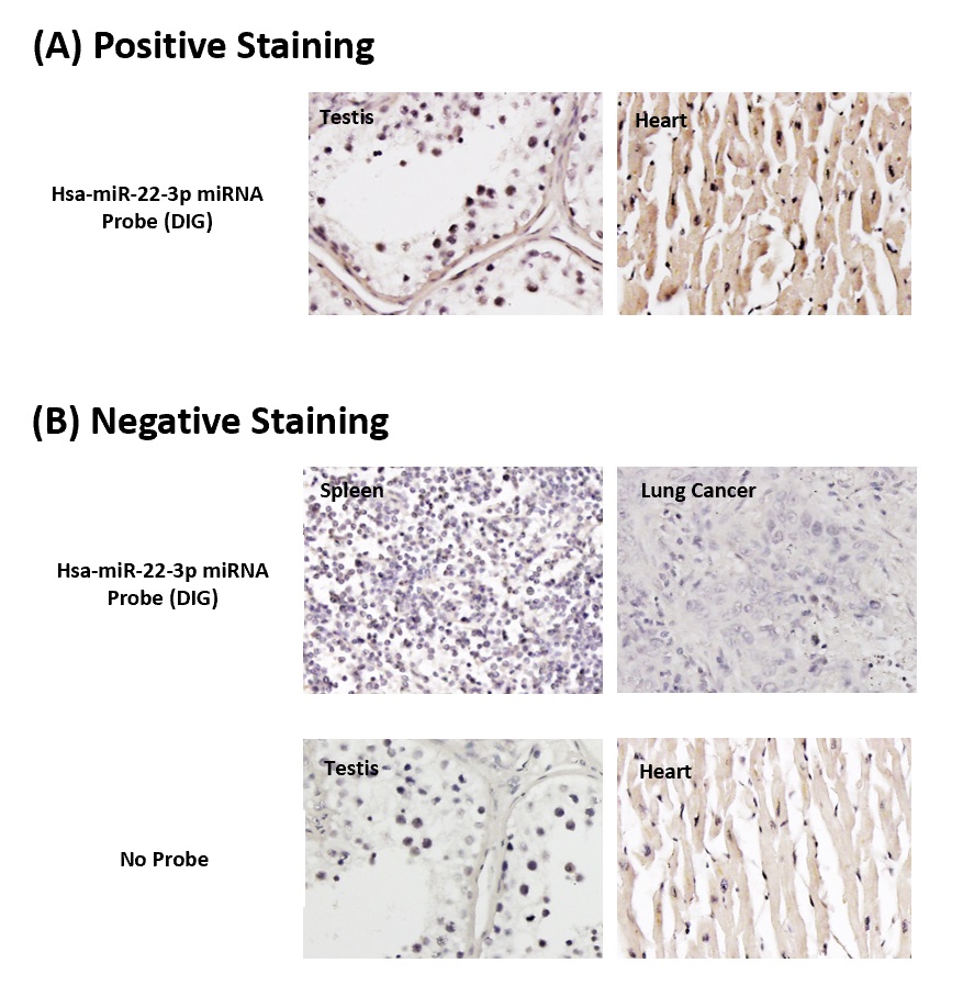 Chromogenic <i>In Situ</i> Hybridization (FFPE Tissue)