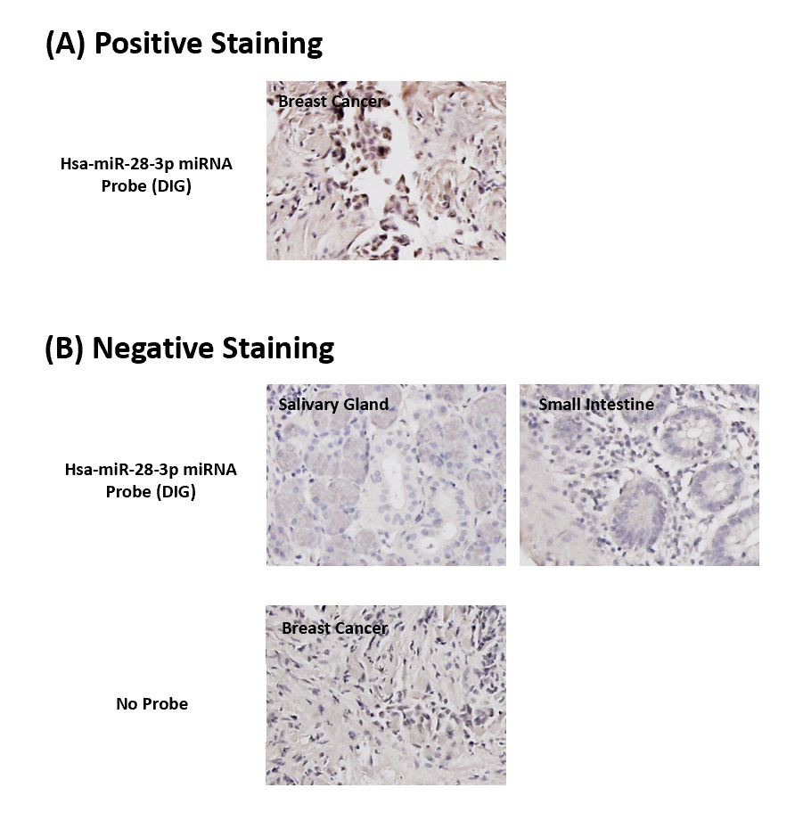 Chromogenic <i>In Situ</i> Hybridization (FFPE Tissue)