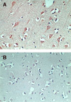 Immunohistochemistry