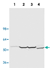 Western Blot (Tissue lysate)