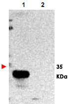 Western Blot (Transfected lysate)