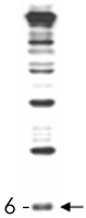 Western Blot (Recombinant protein)