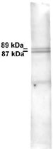 Western Blot (Tissue lysate)