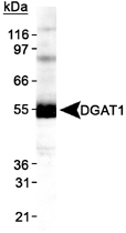 Western Blot (Cell lysate)