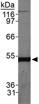 Western Blot (Cell lysate)