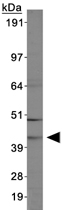 Western Blot (Cell lysate)