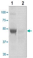 Western Blot (Cell lysate)