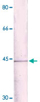 Western Blot (Cell lysate)