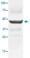 Western Blot (Tissue lysate)