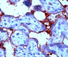 Immunohistochemistry (Formalin/PFA-fixed paraffin-embedded sections)