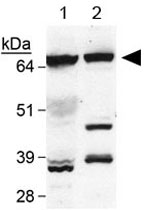 Western Blot (Tissue lysate)