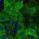 Immunocytochemistry