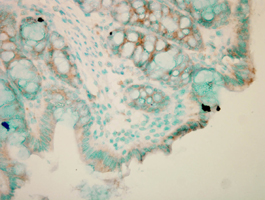 Immunohistochemistry