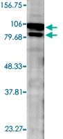 Western Blot (Tissue lysate)