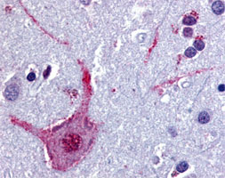 Immunohistochemistry (Formalin/PFA-fixed paraffin-embedded sections)