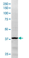 Western Blot (Cell lysate)