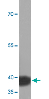 Western Blot (Tissue lysate)