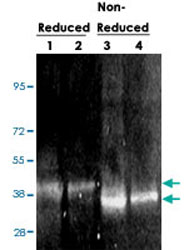 Western Blot (Recombinant protein)