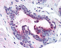 Immunohistochemistry (Formalin/PFA-fixed paraffin-embedded sections)