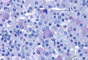 Immunohistochemistry (Formalin/PFA-fixed paraffin-embedded sections)