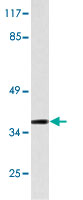 Western Blot (Cell lysate)